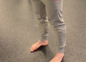 Feet Pronation/Supination